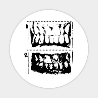 TEETH Magnet